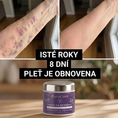 💜 100 000+ PRODANÝCH KUSŮ 💁‍♀️ – PuraCure® Krém na modřiny a posílení pokožky