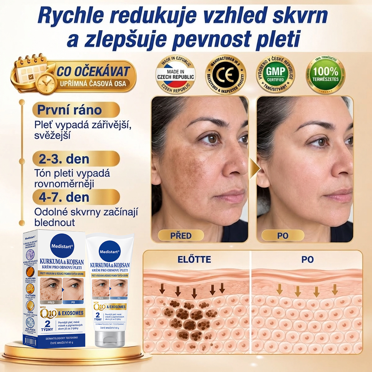 𝑶𝒇𝒊𝒄𝒊𝒂́𝒍𝒏𝒊́ 𝑶𝒃𝒄𝒉𝒐𝒅 | 𝐍𝐨𝐯𝐢𝐧𝐤𝐚! ✨ Medistart® 𝐊𝐮𝐫𝐤𝐮𝐦𝐚 × 𝐊𝐲𝐬𝐞𝐥𝐢𝐧𝐚 𝐤𝐨𝐣𝐨𝐯𝐚́ 𝐍𝐨𝐜̌𝐧𝐢́ 𝐨𝐦𝐥𝐚𝐳𝐮𝐣𝐢́𝐜𝐢́ 𝐤𝐫𝐞́𝐦 — 𝐙𝐞𝐬𝐯𝐞̌𝐭𝐥𝐢 𝐨𝐝𝐨𝐥𝐧𝐞́ 𝐭𝐦𝐚𝐯𝐞́ 𝐬𝐤𝐯𝐫𝐧𝐲 𝐚 𝐯𝐲𝐡𝐥𝐚𝐝̌ 𝐯𝐢𝐝𝐢𝐭𝐞𝐥𝐧𝐞́ 𝐯𝐫𝐚́𝐬𝐤𝐲 𝐛𝐞̌𝐡𝐞𝐦 𝐬𝐩𝐚́𝐧𝐤𝐮 🌙  𝐉𝐞𝐝𝐞𝐧 𝐤𝐫𝐨𝐤 𝐤𝐚𝐳̌𝐝𝐨𝐮 𝐧𝐨𝐜 · 𝐕𝐢𝐝𝐢𝐭𝐞𝐥𝐧𝐚́ 𝐳𝐦𝐞̌𝐧𝐚 𝐳𝐚 𝟕 𝐧𝐨𝐜𝐢́ ✅