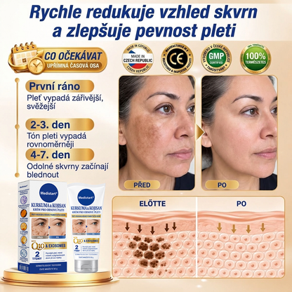 𝑶𝒇𝒊𝒄𝒊𝒂́𝒍𝒏𝒊́ 𝑶𝒃𝒄𝒉𝒐𝒅 | 𝐍𝐨𝐯𝐢𝐧𝐤𝐚! ✨ Medistart® 𝐊𝐮𝐫𝐤𝐮𝐦𝐚 × 𝐊𝐲𝐬𝐞𝐥𝐢𝐧𝐚 𝐤𝐨𝐣𝐨𝐯𝐚́ 𝐍𝐨𝐜̌𝐧𝐢́ 𝐨𝐦𝐥𝐚𝐳𝐮𝐣𝐢́𝐜𝐢́ 𝐤𝐫𝐞́𝐦 — 𝐙𝐞𝐬𝐯𝐞̌𝐭𝐥𝐢 𝐨𝐝𝐨𝐥𝐧𝐞́ 𝐭𝐦𝐚𝐯𝐞́ 𝐬𝐤𝐯𝐫𝐧𝐲 𝐚 𝐯𝐲𝐡𝐥𝐚𝐝̌ 𝐯𝐢𝐝𝐢𝐭𝐞𝐥𝐧𝐞́ 𝐯𝐫𝐚́𝐬𝐤𝐲 𝐛𝐞̌𝐡𝐞𝐦 𝐬𝐩𝐚́𝐧𝐤𝐮 🌙  𝐉𝐞𝐝𝐞𝐧 𝐤𝐫𝐨𝐤 𝐤𝐚𝐳̌𝐝𝐨𝐮 𝐧𝐨𝐜 · 𝐕𝐢𝐝𝐢𝐭𝐞𝐥𝐧𝐚́ 𝐳𝐦𝐞̌𝐧𝐚 𝐳𝐚 𝟕 𝐧𝐨𝐜𝐢́ ✅