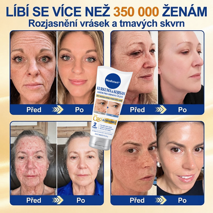 𝑶𝒇𝒊𝒄𝒊𝒂́𝒍𝒏𝒊́ 𝑶𝒃𝒄𝒉𝒐𝒅 | 𝐍𝐨𝐯𝐢𝐧𝐤𝐚! ✨ Medistart® 𝐊𝐮𝐫𝐤𝐮𝐦𝐚 × 𝐊𝐲𝐬𝐞𝐥𝐢𝐧𝐚 𝐤𝐨𝐣𝐨𝐯𝐚́ 𝐍𝐨𝐜̌𝐧𝐢́ 𝐨𝐦𝐥𝐚𝐳𝐮𝐣𝐢́𝐜𝐢́ 𝐤𝐫𝐞́𝐦 — 𝐙𝐞𝐬𝐯𝐞̌𝐭𝐥𝐢 𝐨𝐝𝐨𝐥𝐧𝐞́ 𝐭𝐦𝐚𝐯𝐞́ 𝐬𝐤𝐯𝐫𝐧𝐲 𝐚 𝐯𝐲𝐡𝐥𝐚𝐝̌ 𝐯𝐢𝐝𝐢𝐭𝐞𝐥𝐧𝐞́ 𝐯𝐫𝐚́𝐬𝐤𝐲 𝐛𝐞̌𝐡𝐞𝐦 𝐬𝐩𝐚́𝐧𝐤𝐮 🌙  𝐉𝐞𝐝𝐞𝐧 𝐤𝐫𝐨𝐤 𝐤𝐚𝐳̌𝐝𝐨𝐮 𝐧𝐨𝐜 · 𝐕𝐢𝐝𝐢𝐭𝐞𝐥𝐧𝐚́ 𝐳𝐦𝐞̌𝐧𝐚 𝐳𝐚 𝟕 𝐧𝐨𝐜𝐢́ ✅