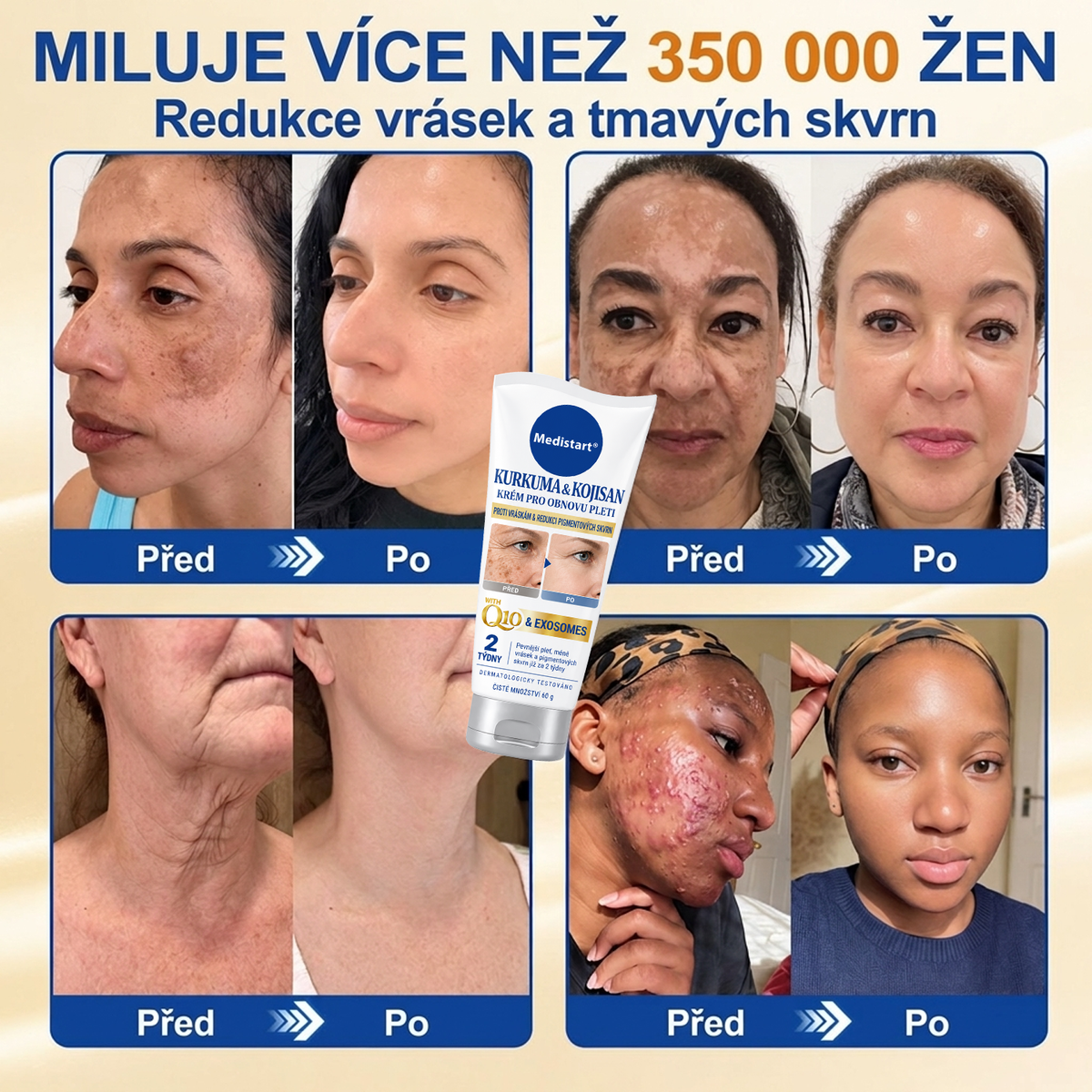 𝑶𝒇𝒊𝒄𝒊𝒂́𝒍𝒏𝒊́ 𝑶𝒃𝒄𝒉𝒐𝒅 | 𝐍𝐨𝐯𝐢𝐧𝐤𝐚! ✨ Medistart® 𝐊𝐮𝐫𝐤𝐮𝐦𝐚 × 𝐊𝐲𝐬𝐞𝐥𝐢𝐧𝐚 𝐤𝐨𝐣𝐨𝐯𝐚́ 𝐍𝐨𝐜̌𝐧𝐢́ 𝐨𝐦𝐥𝐚𝐳𝐮𝐣𝐢́𝐜𝐢́ 𝐤𝐫𝐞́𝐦 — 𝐙𝐞𝐬𝐯𝐞̌𝐭𝐥𝐢 𝐨𝐝𝐨𝐥𝐧𝐞́ 𝐭𝐦𝐚𝐯𝐞́ 𝐬𝐤𝐯𝐫𝐧𝐲 𝐚 𝐯𝐲𝐡𝐥𝐚𝐝̌ 𝐯𝐢𝐝𝐢𝐭𝐞𝐥𝐧𝐞́ 𝐯𝐫𝐚́𝐬𝐤𝐲 𝐛𝐞̌𝐡𝐞𝐦 𝐬𝐩𝐚́𝐧𝐤𝐮 🌙  𝐉𝐞𝐝𝐞𝐧 𝐤𝐫𝐨𝐤 𝐤𝐚𝐳̌𝐝𝐨𝐮 𝐧𝐨𝐜 · 𝐕𝐢𝐝𝐢𝐭𝐞𝐥𝐧𝐚́ 𝐳𝐦𝐞̌𝐧𝐚 𝐳𝐚 𝟕 𝐧𝐨𝐜𝐢́ ✅