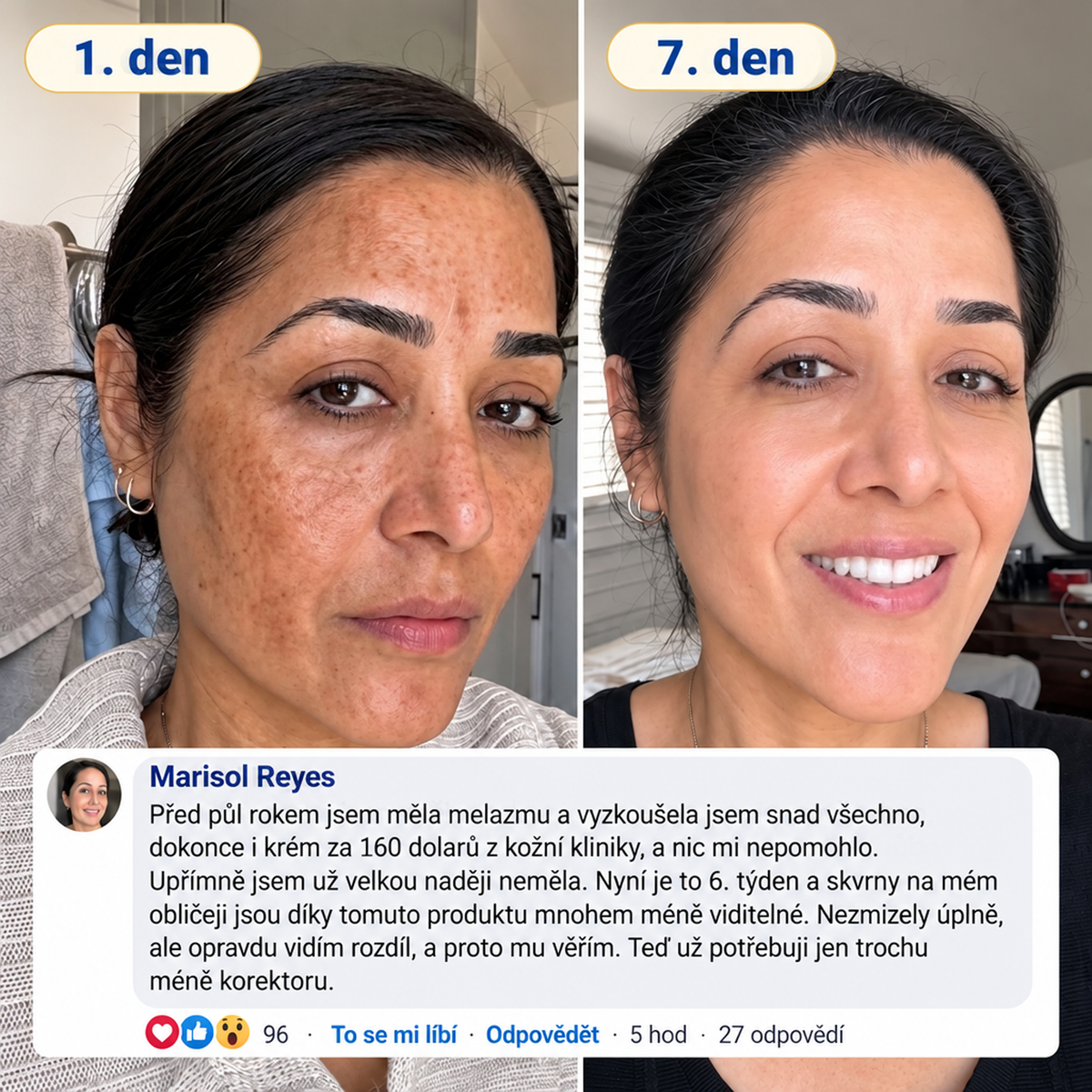 𝑶𝒇𝒊𝒄𝒊𝒂́𝒍𝒏𝒊́ 𝑶𝒃𝒄𝒉𝒐𝒅 | 𝐍𝐨𝐯𝐢𝐧𝐤𝐚! ✨ Medistart® 𝐊𝐮𝐫𝐤𝐮𝐦𝐚 × 𝐊𝐲𝐬𝐞𝐥𝐢𝐧𝐚 𝐤𝐨𝐣𝐨𝐯𝐚́ 𝐍𝐨𝐜̌𝐧𝐢́ 𝐨𝐦𝐥𝐚𝐳𝐮𝐣𝐢́𝐜𝐢́ 𝐤𝐫𝐞́𝐦 — 𝐙𝐞𝐬𝐯𝐞̌𝐭𝐥𝐢 𝐨𝐝𝐨𝐥𝐧𝐞́ 𝐭𝐦𝐚𝐯𝐞́ 𝐬𝐤𝐯𝐫𝐧𝐲 𝐚 𝐯𝐲𝐡𝐥𝐚𝐝̌ 𝐯𝐢𝐝𝐢𝐭𝐞𝐥𝐧𝐞́ 𝐯𝐫𝐚́𝐬𝐤𝐲 𝐛𝐞̌𝐡𝐞𝐦 𝐬𝐩𝐚́𝐧𝐤𝐮 🌙  𝐉𝐞𝐝𝐞𝐧 𝐤𝐫𝐨𝐤 𝐤𝐚𝐳̌𝐝𝐨𝐮 𝐧𝐨𝐜 · 𝐕𝐢𝐝𝐢𝐭𝐞𝐥𝐧𝐚́ 𝐳𝐦𝐞̌𝐧𝐚 𝐳𝐚 𝟕 𝐧𝐨𝐜𝐢́ ✅
