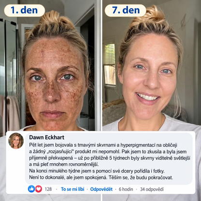𝑶𝒇𝒊𝒄𝒊𝒂́𝒍𝒏𝒊́ 𝑶𝒃𝒄𝒉𝒐𝒅 | 𝐍𝐨𝐯𝐢𝐧𝐤𝐚! ✨ Medistart® 𝐊𝐮𝐫𝐤𝐮𝐦𝐚 × 𝐊𝐲𝐬𝐞𝐥𝐢𝐧𝐚 𝐤𝐨𝐣𝐨𝐯𝐚́ 𝐍𝐨𝐜̌𝐧𝐢́ 𝐨𝐦𝐥𝐚𝐳𝐮𝐣𝐢́𝐜𝐢́ 𝐤𝐫𝐞́𝐦 — 𝐙𝐞𝐬𝐯𝐞̌𝐭𝐥𝐢 𝐨𝐝𝐨𝐥𝐧𝐞́ 𝐭𝐦𝐚𝐯𝐞́ 𝐬𝐤𝐯𝐫𝐧𝐲 𝐚 𝐯𝐲𝐡𝐥𝐚𝐝̌ 𝐯𝐢𝐝𝐢𝐭𝐞𝐥𝐧𝐞́ 𝐯𝐫𝐚́𝐬𝐤𝐲 𝐛𝐞̌𝐡𝐞𝐦 𝐬𝐩𝐚́𝐧𝐤𝐮 🌙  𝐉𝐞𝐝𝐞𝐧 𝐤𝐫𝐨𝐤 𝐤𝐚𝐳̌𝐝𝐨𝐮 𝐧𝐨𝐜 · 𝐕𝐢𝐝𝐢𝐭𝐞𝐥𝐧𝐚́ 𝐳𝐦𝐞̌𝐧𝐚 𝐳𝐚 𝟕 𝐧𝐨𝐜𝐢́ ✅