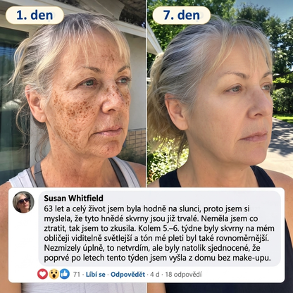 𝑶𝒇𝒊𝒄𝒊𝒂́𝒍𝒏𝒊́ 𝑶𝒃𝒄𝒉𝒐𝒅 | 𝐍𝐨𝐯𝐢𝐧𝐤𝐚! ✨ Medistart® 𝐊𝐮𝐫𝐤𝐮𝐦𝐚 × 𝐊𝐲𝐬𝐞𝐥𝐢𝐧𝐚 𝐤𝐨𝐣𝐨𝐯𝐚́ 𝐍𝐨𝐜̌𝐧𝐢́ 𝐨𝐦𝐥𝐚𝐳𝐮𝐣𝐢́𝐜𝐢́ 𝐤𝐫𝐞́𝐦 — 𝐙𝐞𝐬𝐯𝐞̌𝐭𝐥𝐢 𝐨𝐝𝐨𝐥𝐧𝐞́ 𝐭𝐦𝐚𝐯𝐞́ 𝐬𝐤𝐯𝐫𝐧𝐲 𝐚 𝐯𝐲𝐡𝐥𝐚𝐝̌ 𝐯𝐢𝐝𝐢𝐭𝐞𝐥𝐧𝐞́ 𝐯𝐫𝐚́𝐬𝐤𝐲 𝐛𝐞̌𝐡𝐞𝐦 𝐬𝐩𝐚́𝐧𝐤𝐮 🌙  𝐉𝐞𝐝𝐞𝐧 𝐤𝐫𝐨𝐤 𝐤𝐚𝐳̌𝐝𝐨𝐮 𝐧𝐨𝐜 · 𝐕𝐢𝐝𝐢𝐭𝐞𝐥𝐧𝐚́ 𝐳𝐦𝐞̌𝐧𝐚 𝐳𝐚 𝟕 𝐧𝐨𝐜𝐢́ ✅