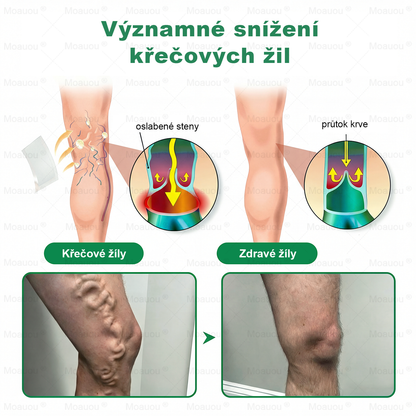 🌿Moauou® Mikrojehličková náplast pro péči o křečové žíly ✅Cílená péče pro unavené a těžké nohy s pocitem pnutí ⚡VELKÁ AKCE!