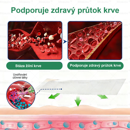 🌿Moauou® Mikrojehličková náplast pro péči o křečové žíly ✅Cílená péče pro unavené a těžké nohy s pocitem pnutí ⚡VELKÁ AKCE!