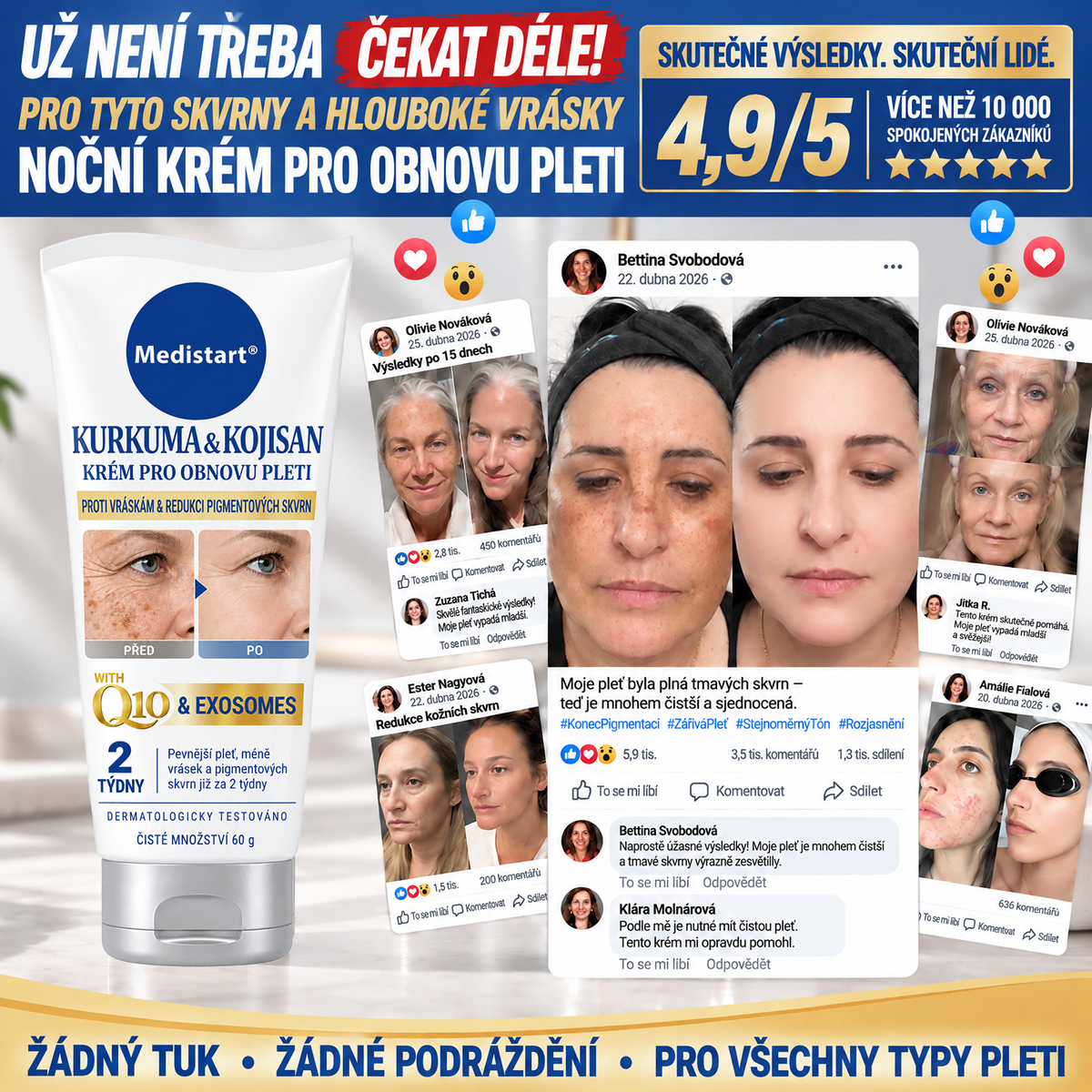 𝑶𝒇𝒊𝒄𝒊𝒂́𝒍𝒏𝒊́ 𝑶𝒃𝒄𝒉𝒐𝒅 | 𝐍𝐨𝐯𝐢𝐧𝐤𝐚! ✨ Medistart® 𝐊𝐮𝐫𝐤𝐮𝐦𝐚 × 𝐊𝐲𝐬𝐞𝐥𝐢𝐧𝐚 𝐤𝐨𝐣𝐨𝐯𝐚́ 𝐍𝐨𝐜̌𝐧𝐢́ 𝐨𝐦𝐥𝐚𝐳𝐮𝐣𝐢́𝐜𝐢́ 𝐤𝐫𝐞́𝐦 — 𝐙𝐞𝐬𝐯𝐞̌𝐭𝐥𝐢 𝐨𝐝𝐨𝐥𝐧𝐞́ 𝐭𝐦𝐚𝐯𝐞́ 𝐬𝐤𝐯𝐫𝐧𝐲 𝐚 𝐯𝐲𝐡𝐥𝐚𝐝̌ 𝐯𝐢𝐝𝐢𝐭𝐞𝐥𝐧𝐞́ 𝐯𝐫𝐚́𝐬𝐤𝐲 𝐛𝐞̌𝐡𝐞𝐦 𝐬𝐩𝐚́𝐧𝐤𝐮 🌙  𝐉𝐞𝐝𝐞𝐧 𝐤𝐫𝐨𝐤 𝐤𝐚𝐳̌𝐝𝐨𝐮 𝐧𝐨𝐜 · 𝐕𝐢𝐝𝐢𝐭𝐞𝐥𝐧𝐚́ 𝐳𝐦𝐞̌𝐧𝐚 𝐳𝐚 𝟕 𝐧𝐨𝐜𝐢́ ✅