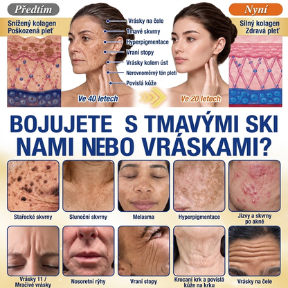 𝑶𝒇𝒊𝒄𝒊𝒂́𝒍𝒏𝒊́ 𝑶𝒃𝒄𝒉𝒐𝒅 | 𝐍𝐨𝐯𝐢𝐧𝐤𝐚! ✨ Medistart® 𝐊𝐮𝐫𝐤𝐮𝐦𝐚 × 𝐊𝐲𝐬𝐞𝐥𝐢𝐧𝐚 𝐤𝐨𝐣𝐨𝐯𝐚́ 𝐍𝐨𝐜̌𝐧𝐢́ 𝐨𝐦𝐥𝐚𝐳𝐮𝐣𝐢́𝐜𝐢́ 𝐤𝐫𝐞́𝐦 — 𝐙𝐞𝐬𝐯𝐞̌𝐭𝐥𝐢 𝐨𝐝𝐨𝐥𝐧𝐞́ 𝐭𝐦𝐚𝐯𝐞́ 𝐬𝐤𝐯𝐫𝐧𝐲 𝐚 𝐯𝐲𝐡𝐥𝐚𝐝̌ 𝐯𝐢𝐝𝐢𝐭𝐞𝐥𝐧𝐞́ 𝐯𝐫𝐚́𝐬𝐤𝐲 𝐛𝐞̌𝐡𝐞𝐦 𝐬𝐩𝐚́𝐧𝐤𝐮 🌙  𝐉𝐞𝐝𝐞𝐧 𝐤𝐫𝐨𝐤 𝐤𝐚𝐳̌𝐝𝐨𝐮 𝐧𝐨𝐜 · 𝐕𝐢𝐝𝐢𝐭𝐞𝐥𝐧𝐚́ 𝐳𝐦𝐞̌𝐧𝐚 𝐳𝐚 𝟕 𝐧𝐨𝐜𝐢́ ✅