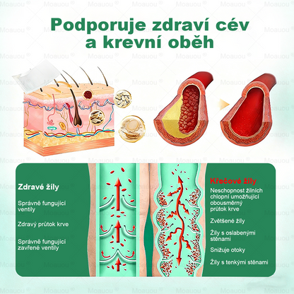 🌿Moauou® Mikrojehličková náplast pro péči o křečové žíly ✅Cílená péče pro unavené a těžké nohy s pocitem pnutí ⚡VELKÁ AKCE!