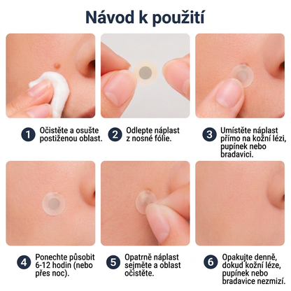 ✨✨PuraCure® 2v1 mikrojehličková a hydrogelová náplast🍀 | Pomáhá odstranit vystouplá znaménka, akné, ploché bradavice a kožní výrůstky | Pomáhá zlepšit vzhled vrásek, jizev a nedokonalostí pleti | Neviditelné náplasti na obličej i tělo